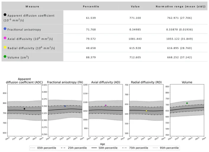 A table of five diffusion measures with percentile, value and normative range, above five charts plotting the patient's value against percentile bands by age
