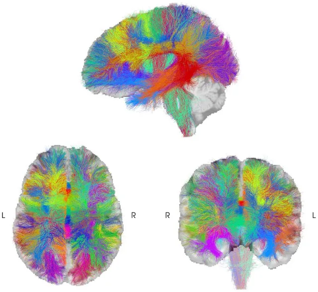 A whole-brain tractogram in three views, sagittal, axial and coronal, with white-matter fibers colored by bundle