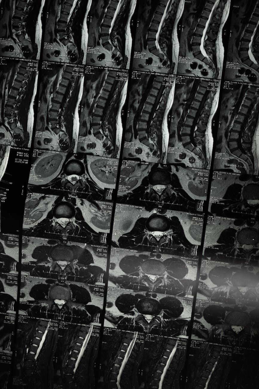 MRI scans showing spine imaging