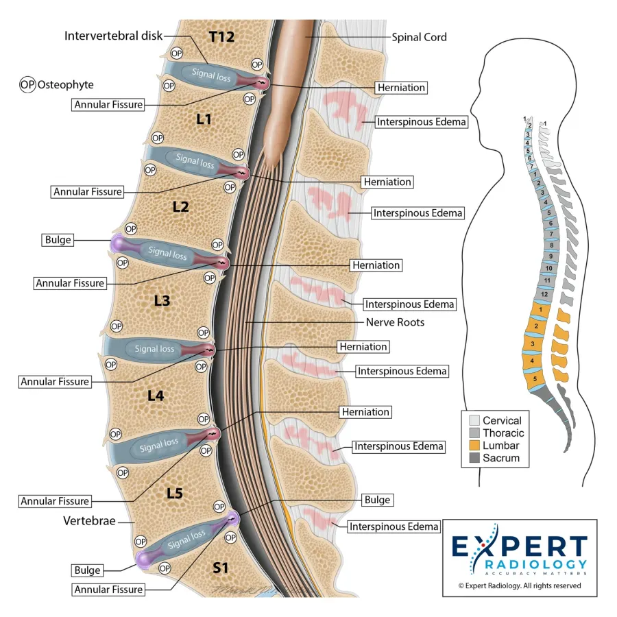 Lumbar spine illustration sample