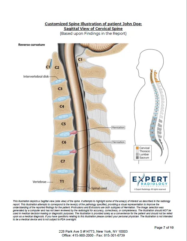 Spine anatomy illustration