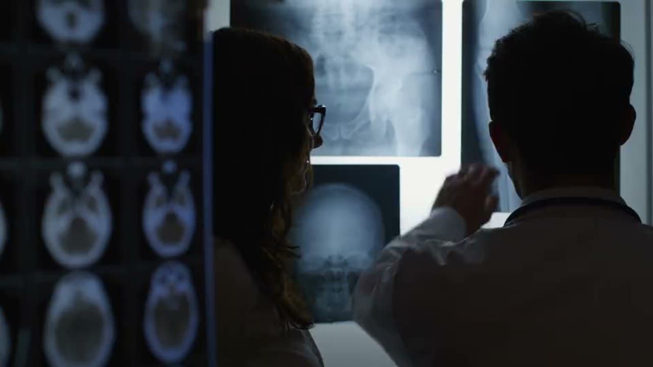 Why Do Radiology Reports Vary, and What Makes One Clear? article cover