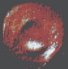 Early human finger MRI image from Mansfield and Maudsley in 1977
