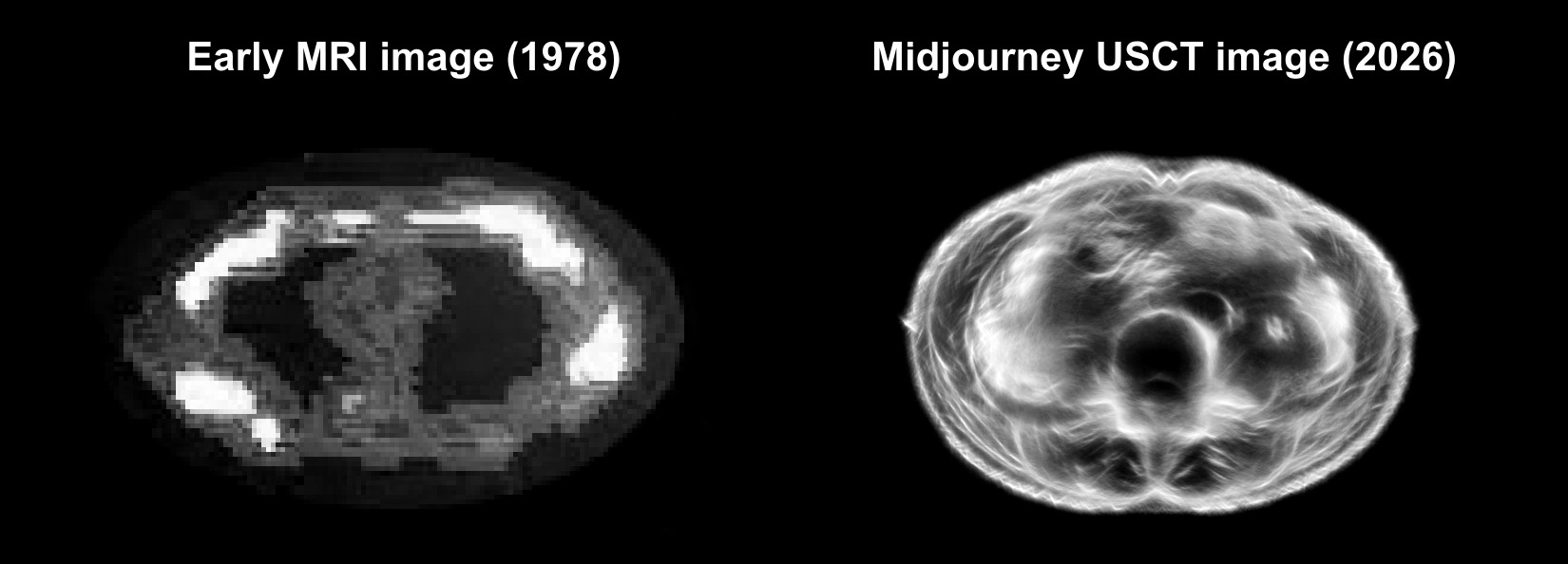 Comparison of an early MRI image from 1978 and a Midjourney USCT image from 2026