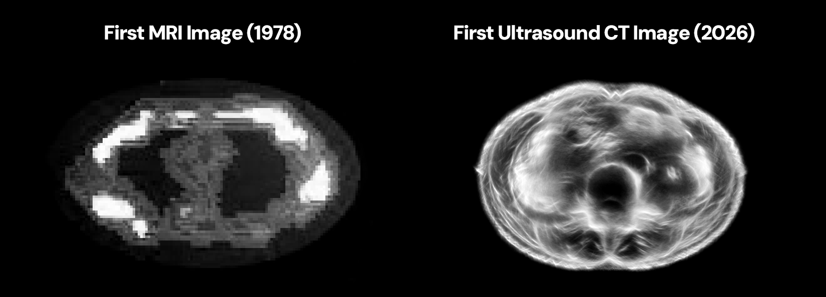 Official Midjourney Medical comparison of an early MRI image and its first ultrasound CT image