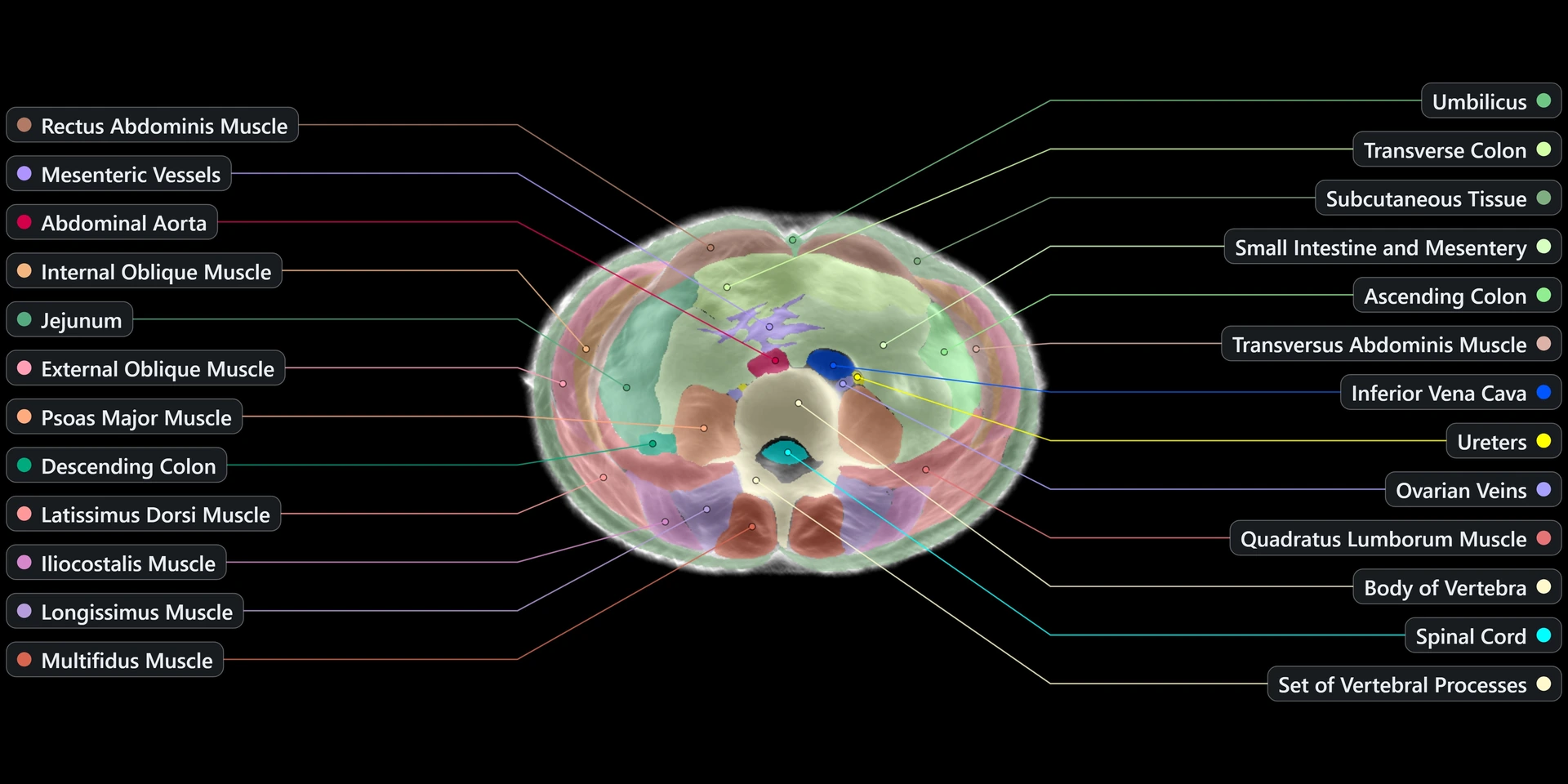 Midjourney Medical segmented and labeled female lower abdomen USCT slice from the official scan gallery