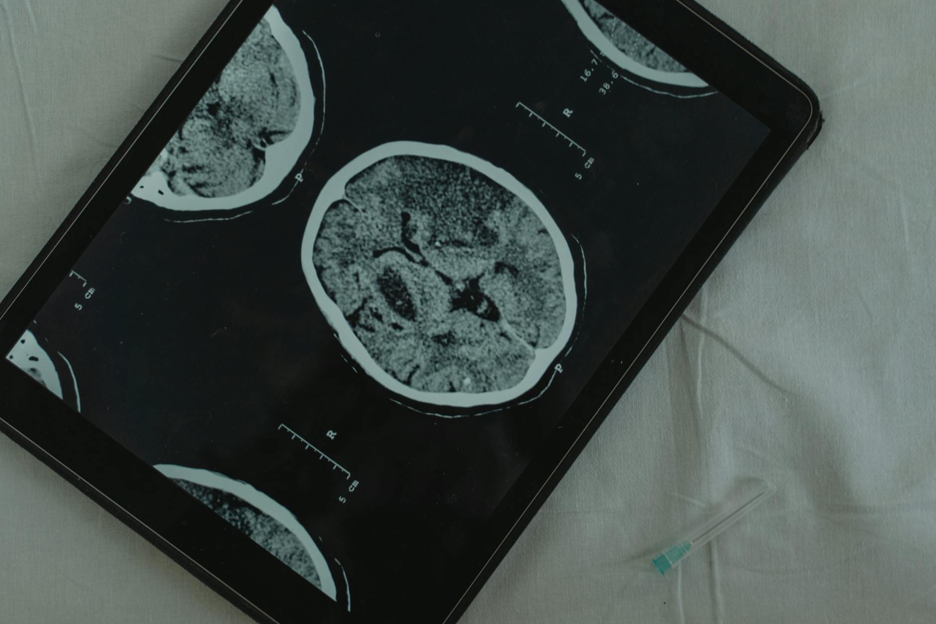 CT scan images on medical displays