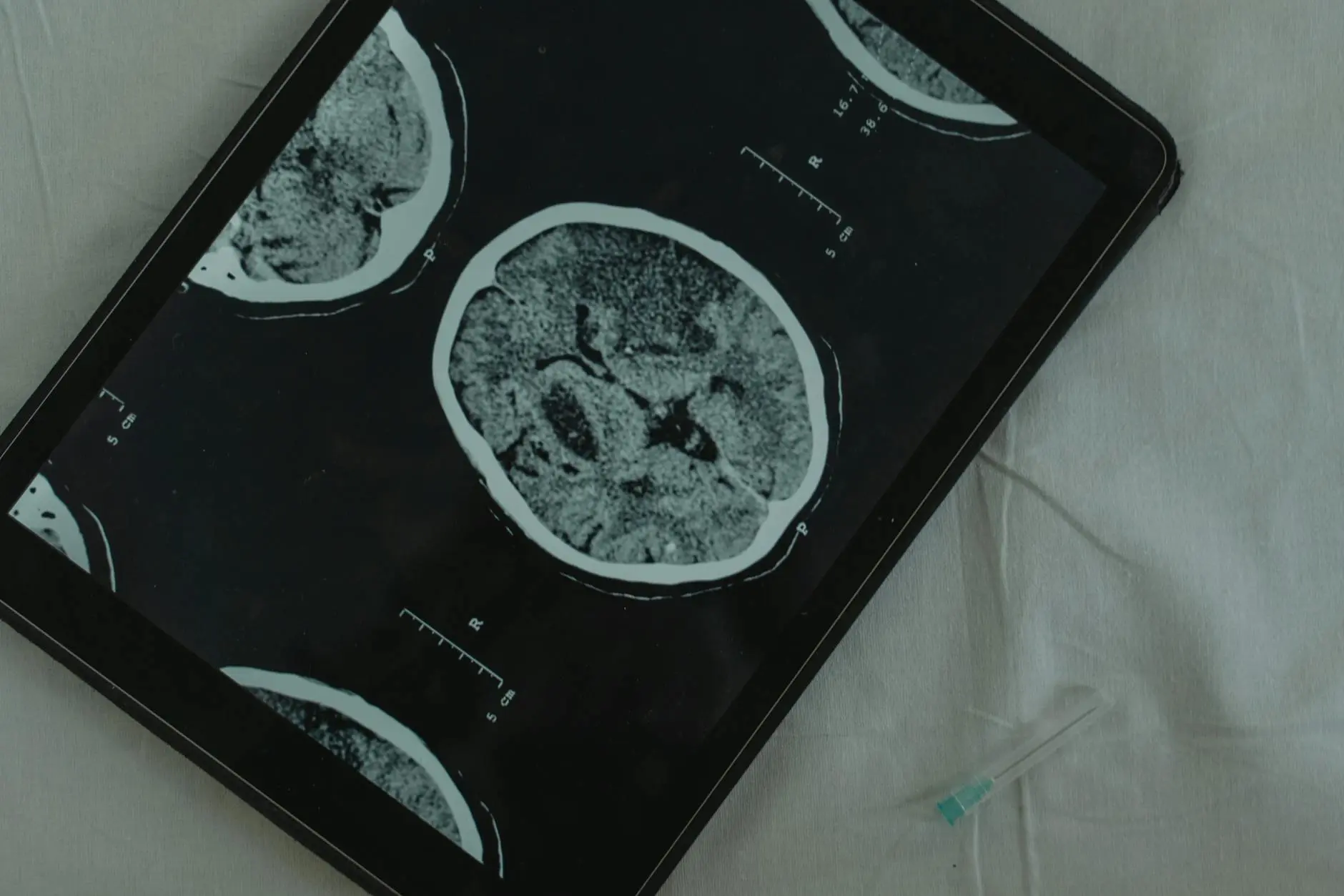 CT scan images on medical displays