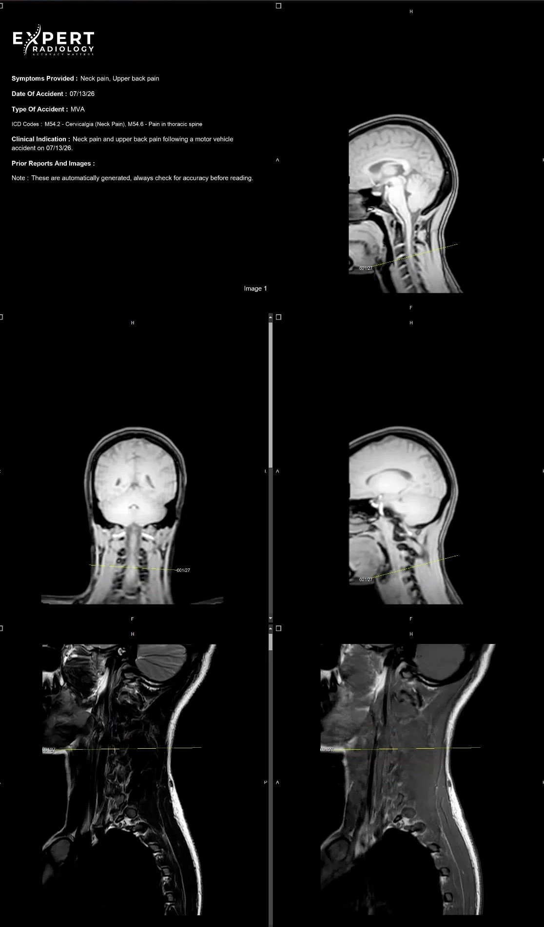 Diagnostic viewer showing clinical context and multiple cervical MRI series
