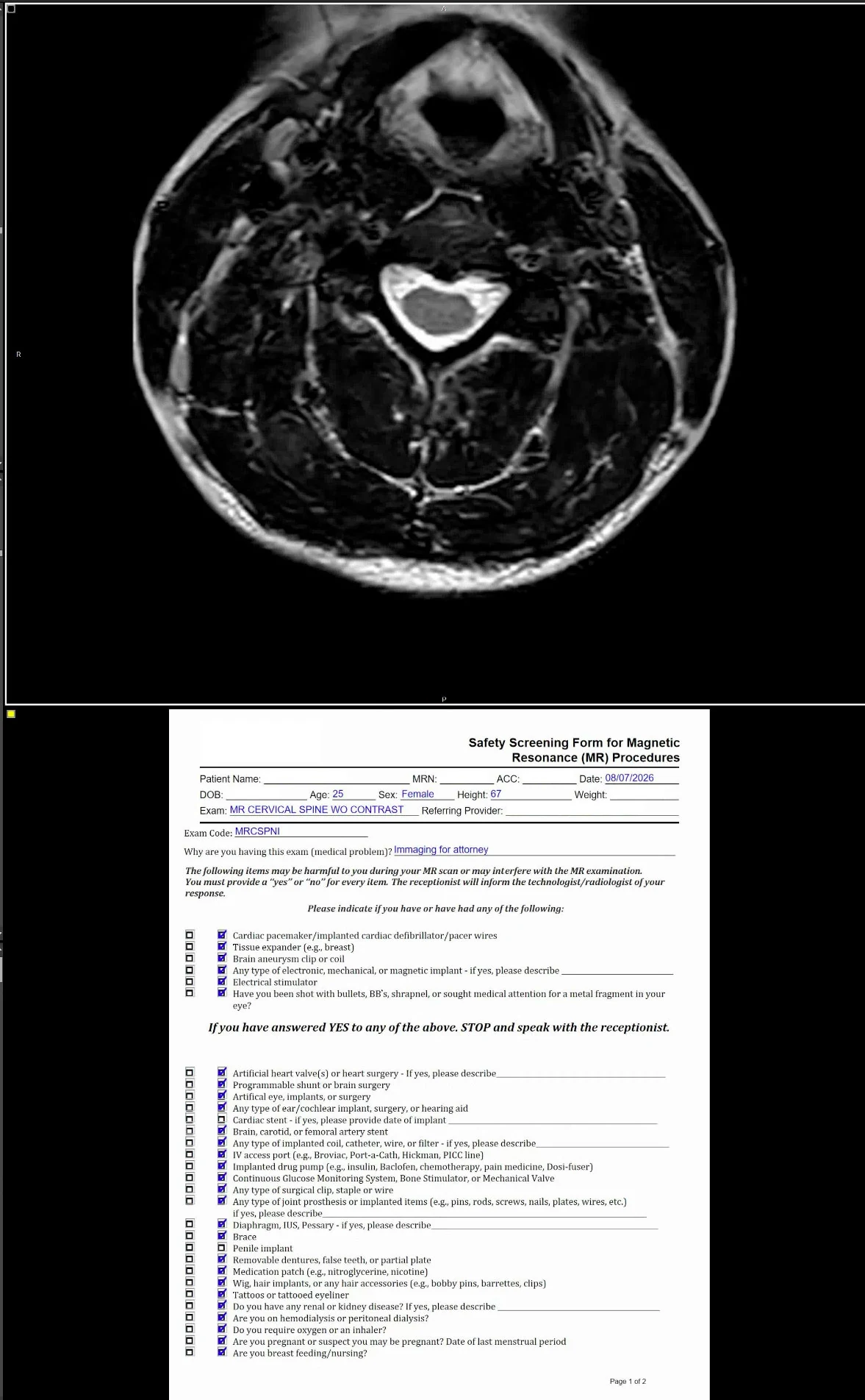 Diagnostic viewer showing a cervical MRI above its supporting screening form