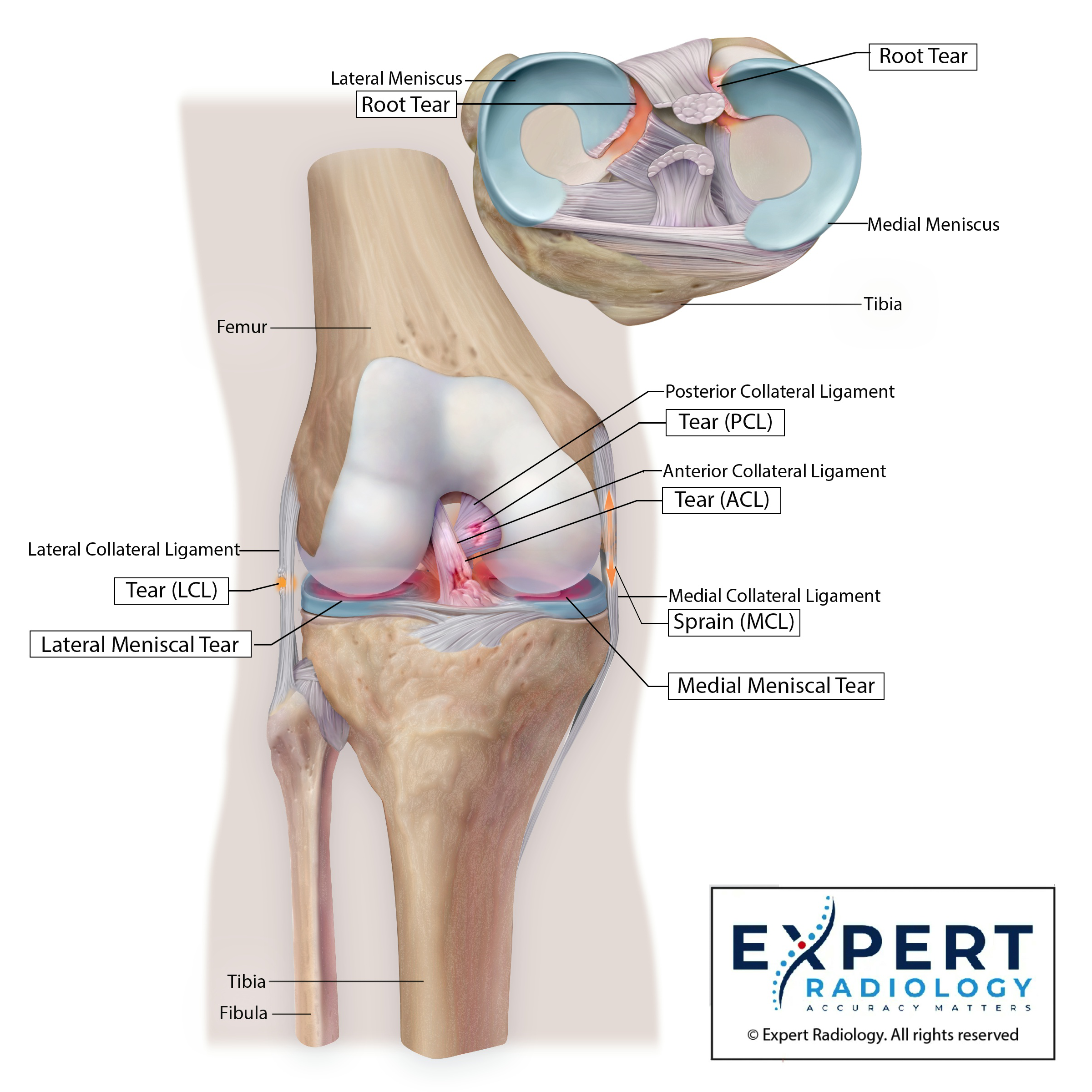 Knee Deep View Illustration