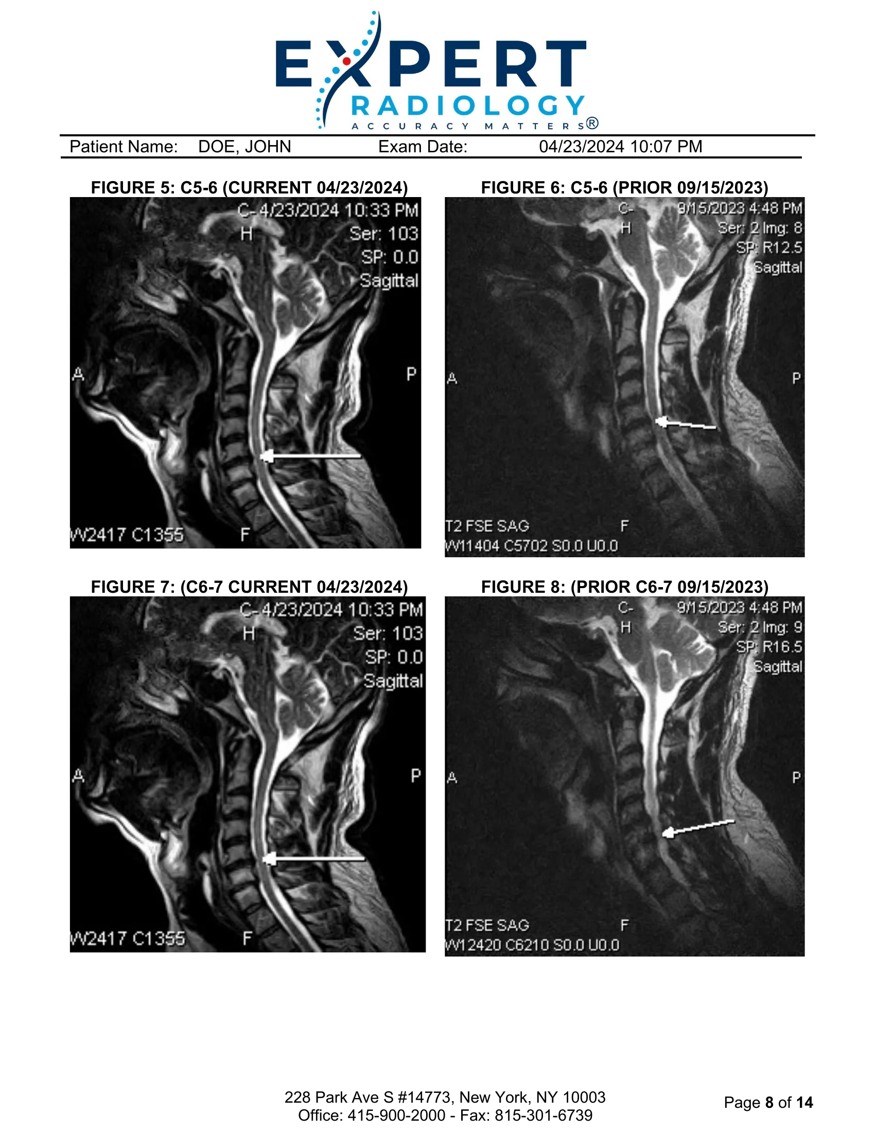 Cropped visual excerpt of current and prior MRI comparison panels