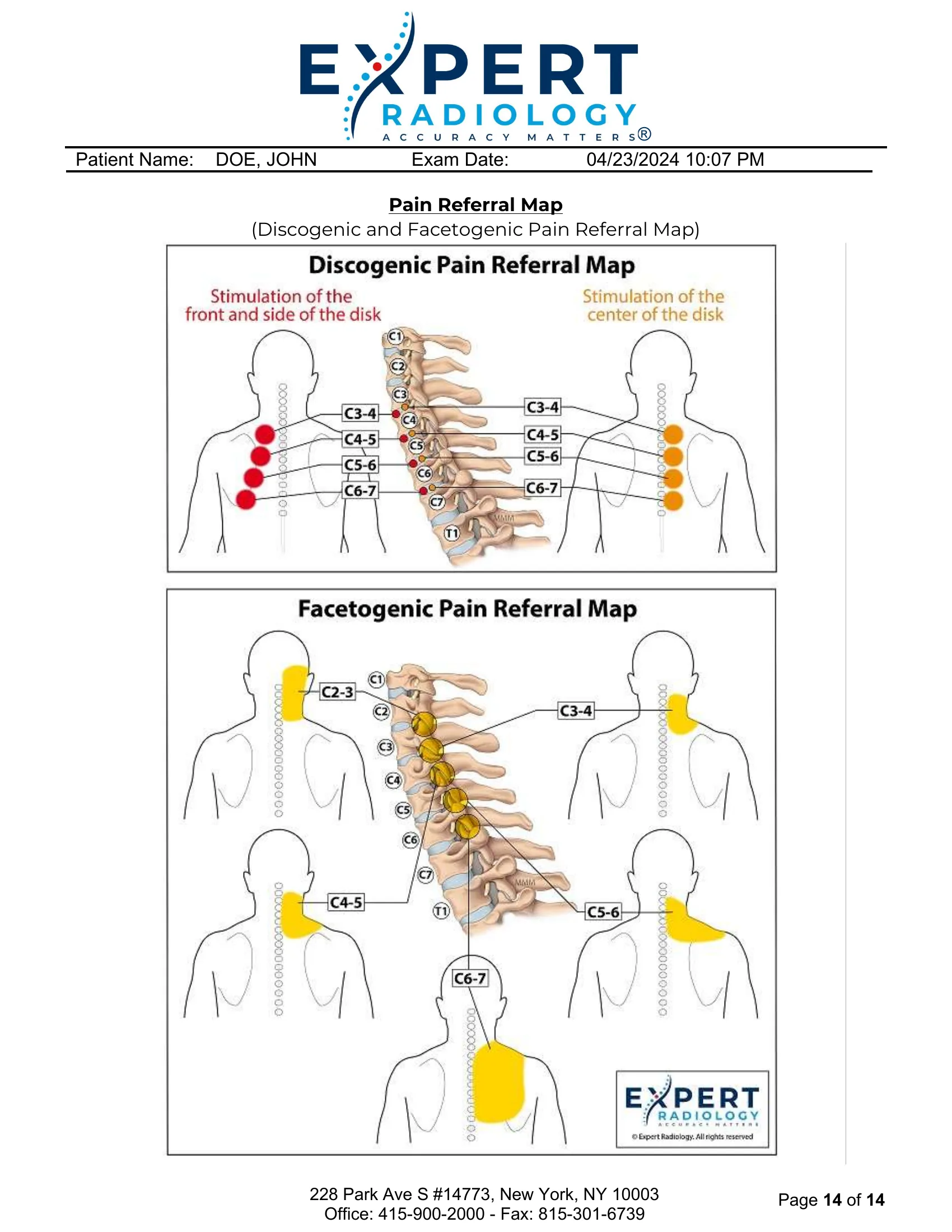 Cropped visual excerpt of pain referral map graphics