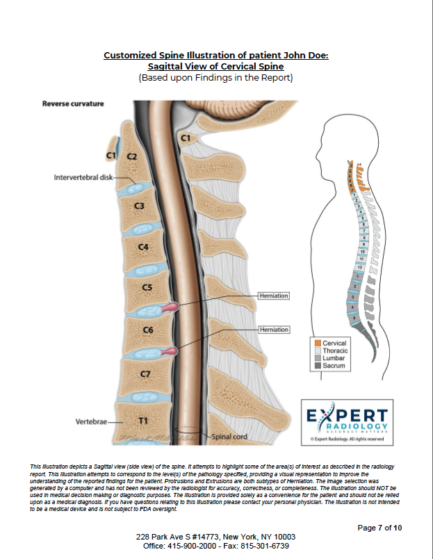 Spine Report