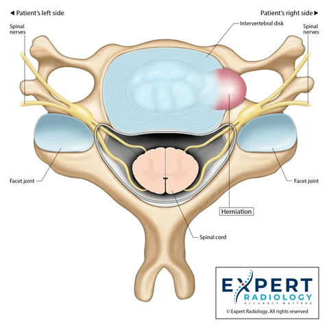 Cervical Spine Axial Illustration