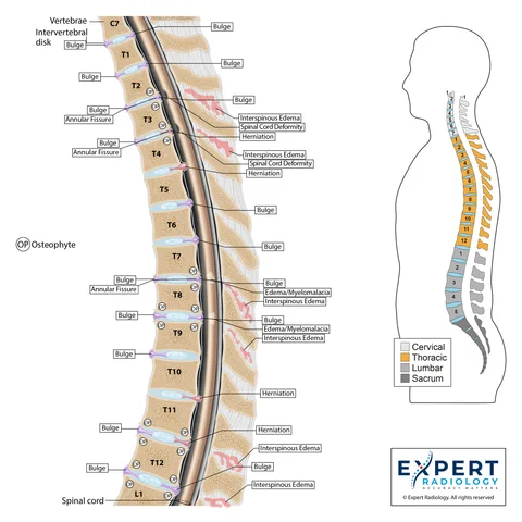 Expert Radiology illustration of the thoracic spine in sagittal view