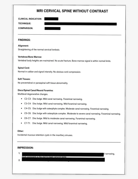 Representative text-only C-spine report example