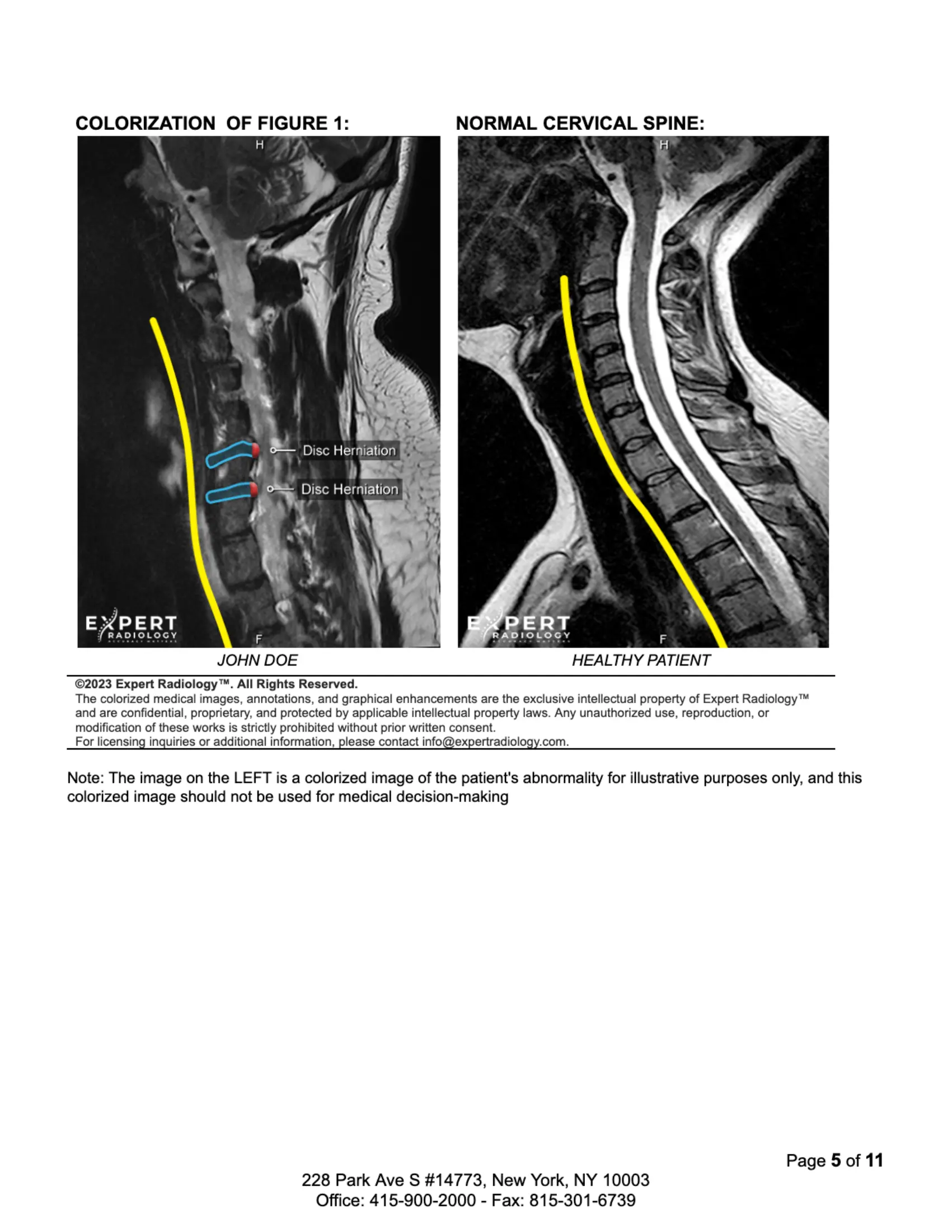 Cropped study review image with annotated cervical finding