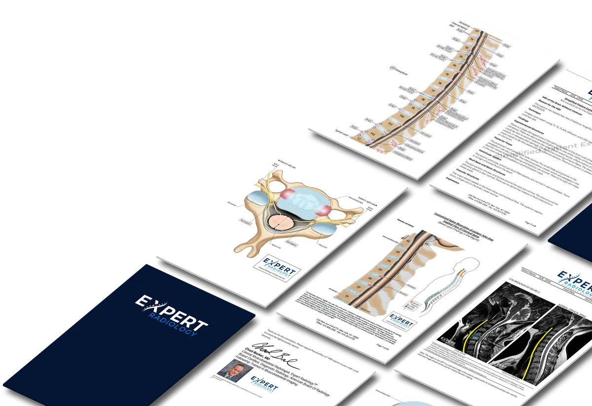 PrecisionPlus v3™ Report Pages