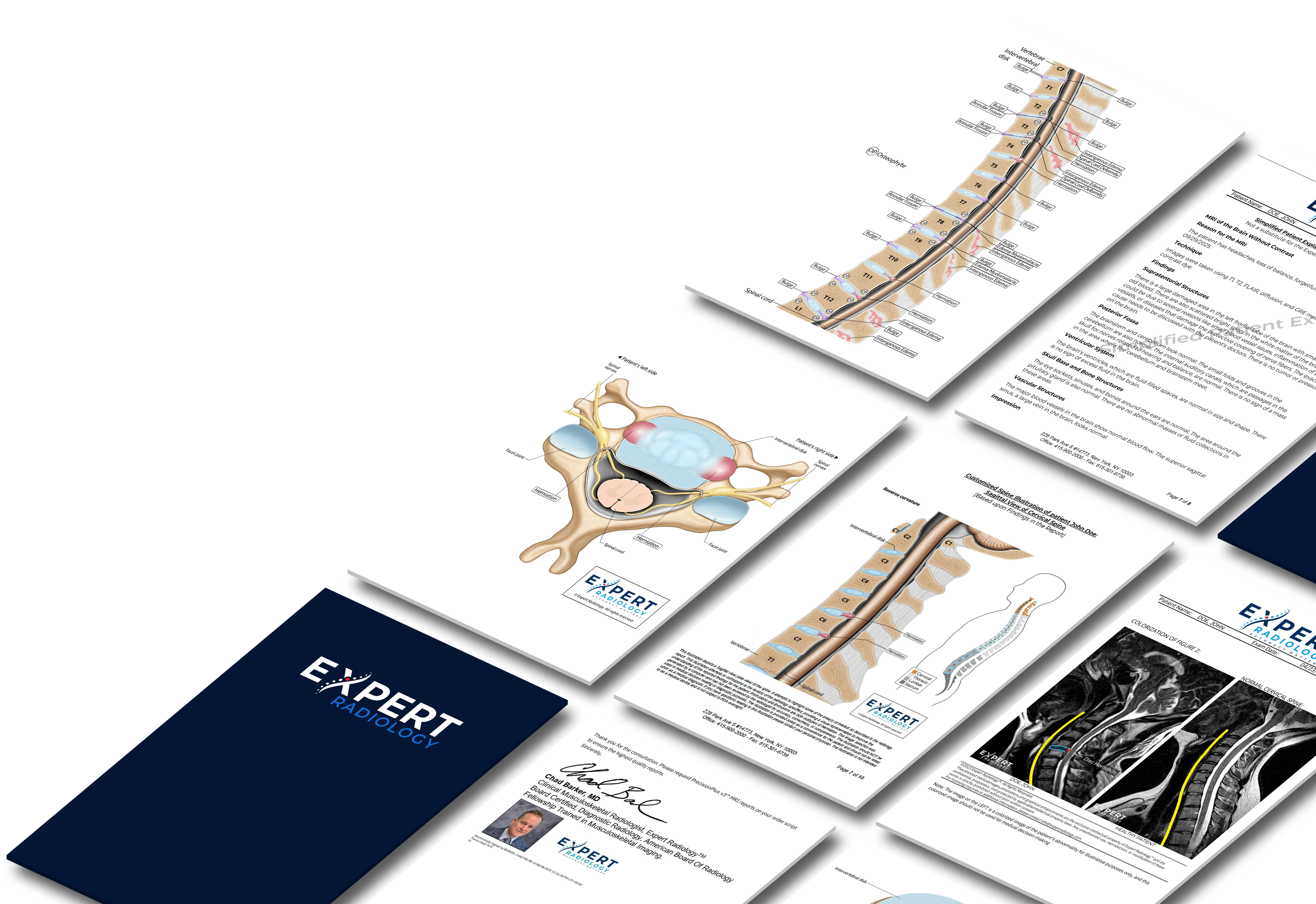 PrecisionPlus v3™ Report Pages