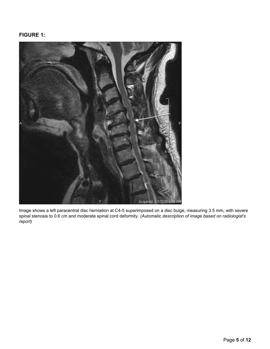 Page 5: Figure 1 MRI sagittal view with annotation arrow