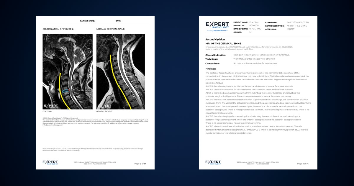 Report Enhancement | Upgrade Any Radiology Report to PrecisionPlus v3 ...